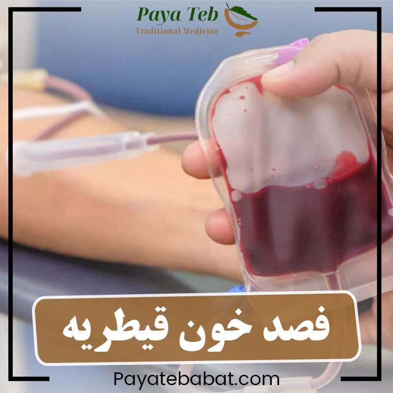 فصد خون در قیطریه