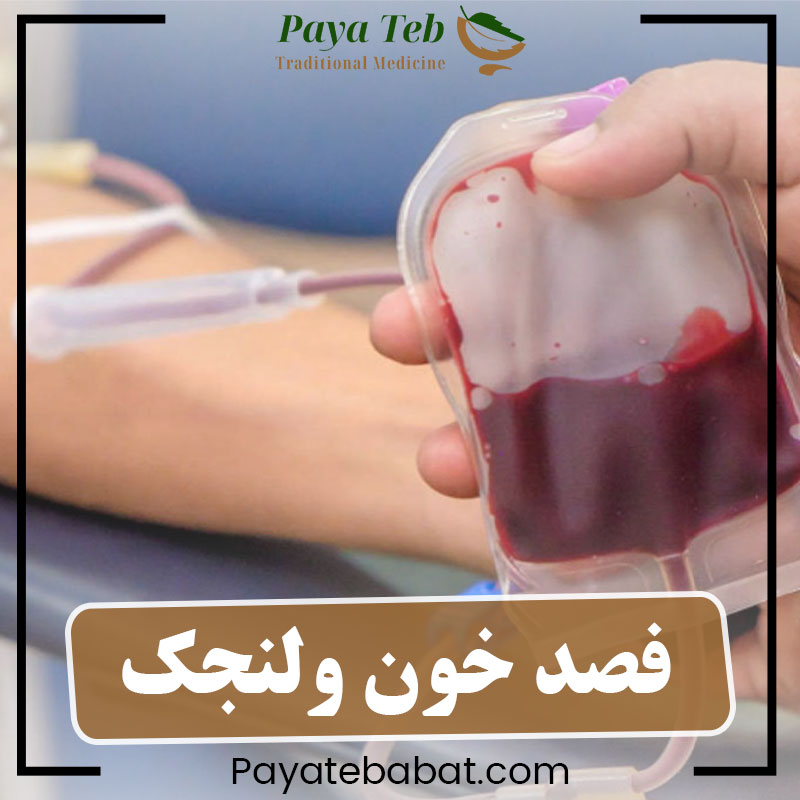 فصد خون در ولنجک