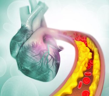 فواید فصد خون برای کبد چرب